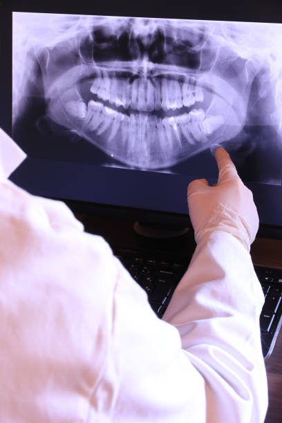 Best Emergency Root Canal Therapy in Point Venture, TX